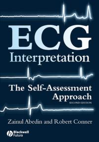 Book Cover for ECG Interpretation by Zainul Abedin, Robert P Conner