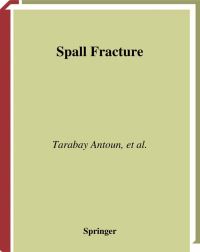 Book Cover for Spall Fracture by Tarabay Antoun