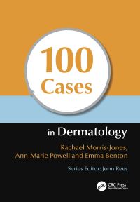 Book Cover for 100 Cases in Dermatology by Rachael MorrisJones, AnnMarie Powell, Emma Benton