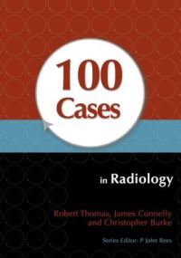 Book Cover for 100 Cases in Radiology by Robert Thomas, James Connelly, Christopher Burke