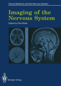 Book Cover for Imaging of the Nervous System by Paul Butler