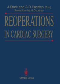 Book Cover for Reoperations in Cardiac Surgery by Jarda Stark, David C Jr Sabiston, M Courtney, Al Pacifico