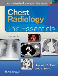 Book Cover for Chest Radiology by Jannette Collins, Eric J Stern, Jannette Collins