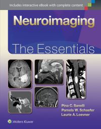 Book Cover for Neuroimaging by Pina C Sanelli, Pamela W Schaefer, Laurie A Loevner