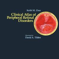 Book Cover for Clinical Atlas of Peripheral Retinal Disorders by Keith M Zinn