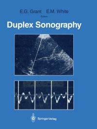 Book Cover for Duplex Sonography by Edward G Grant, E Maureen White