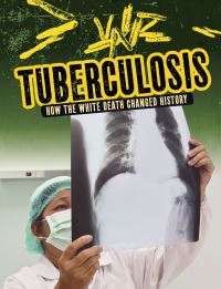 Book Cover for Tuberculosis by Mark L Lewis