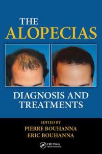 Book Cover for The Alopecias by P Bouhanna, Eric Bouhanna