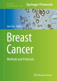 Book Cover for Breast Cancer by Jian Cao