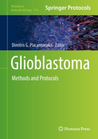 Book Cover for Glioblastoma by Dimitris G Placantonakis