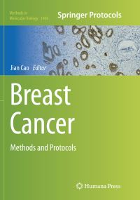 Book Cover for Breast Cancer by Jian Cao