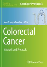 Book Cover for Colorectal Cancer by JeanFrançois Beaulieu