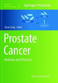 Book Cover for Prostate Cancer by Zoran Culig