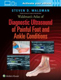 Book Cover for Waldman's Atlas of Diagnostic Ultrasound of Painful Foot and Ankle Conditions by Steven D Waldman