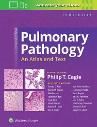 Book Cover for Pulmonary Pathology by Philip T Cagle