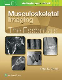 Book Cover for Musculoskeletal Imaging by Felix S Chew