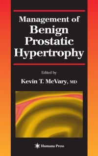 Book Cover for Management of Benign Prostatic Hypertrophy by Kevin T McVary