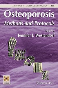 Book Cover for Osteoporosis by Jennifer J Westendorf