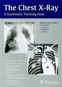 Book Cover for Chest X-Ray by Matthias Hofer