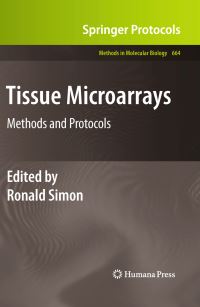 Book Cover for Tissue Microarrays by Ronald Simon