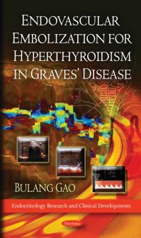 Book Cover for Endovascular Embolization for Hyperthyroidism in Graves' Disease by Bulang Gao