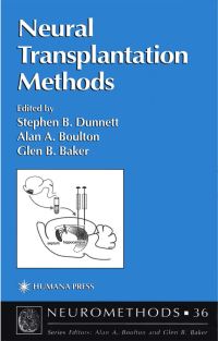 Book Cover for Neural Transplantation Methods by S B Dunnett, A A Boulton, Glen B Baker