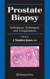Book Cover for Prostate Biopsy by J Stephen Jones