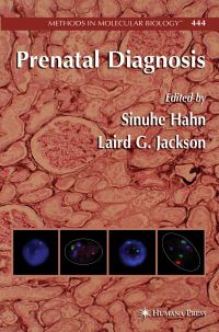 Book Cover for Prenatal Diagnosis by Sinuhe Hahn, Laird G Jackson