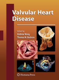 Book Cover for Valvular Heart Disease by Andrew Wang, Thomas M Bashore