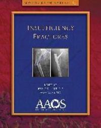 Book Cover for Insufficiency Fractures by American Academy of Orthopaedic Surgeons