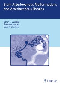 Book Cover for Brain Arteriovenous Malformations and Arteriovenous Fistulas by Aaron S Dumont, Jason P Sheehan, Giuseppe Lanzino