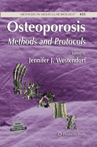 Book Cover for Osteoporosis by Jennifer Westendorf