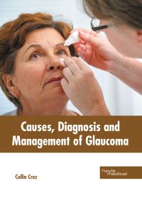Book Cover for Causes, Diagnosis and Management of Glaucoma by Collin Cruz