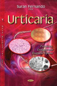 Book Cover for Urticaria by Suran Fernando