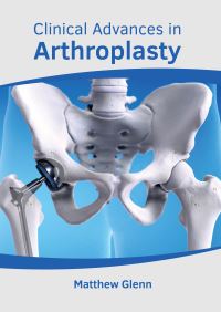 Book Cover for Clinical Advances in Arthroplasty by Matthew Glenn