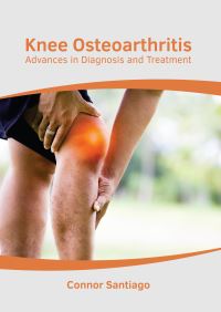 Book Cover for Knee Osteoarthritis by Connor Santiago