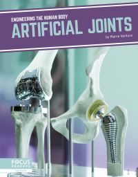 Book Cover for Artificial Joints. Paperback by Marne Ventura