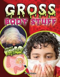Book Cover for Gross Body Stuff by Darla Duhaime