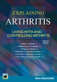Book Cover for An Emerald Guide to Explaining Arthritis by Ellen Baxendale