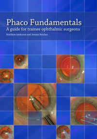 Book Cover for Phaco Fundamentals by Matthew Anderson, Jeremy Butcher
