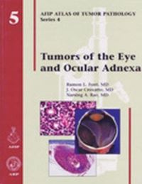 Book Cover for Tumors of the Eye and Ocular Adnexa by Ramon L Font, J Oscar Croxatto, Narsing A Rao