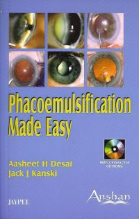 Book Cover for Phacoemulsification Made Easy by Aasheet H. Desai, Jack J. Kanski