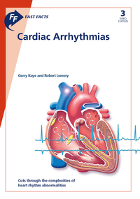 Book Cover for Cardiac Arrhythmias by Gerry Kaye, Robert Lemery