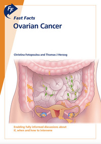 Book Cover for Ovarian Cancer by Christina Fotopoulou, Thomas Herzog