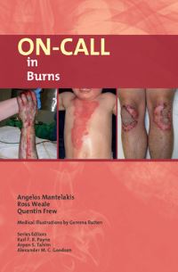 Book Cover for On-Call in Burns by Angelos Mantelakis, Ross Weale, Quentin Frew