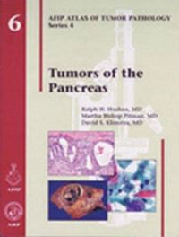 Book Cover for Tumors of the Pancreas by Ralph H Hruban, Martha Bishop Pitman, David S Klimstra