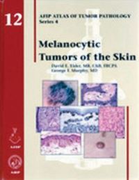 Book Cover for Melanocytic Tumors of the Skin by David E Elder, George F Murphy