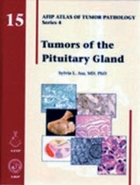 Book Cover for Tumors of the Pituitary Gland by Sylvia L Asa