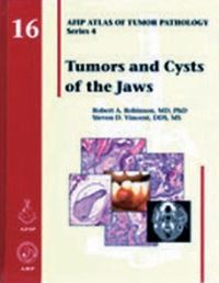Book Cover for Tumors and Cysts of the Jaws by Robert A Robinson, Steven D Vincent