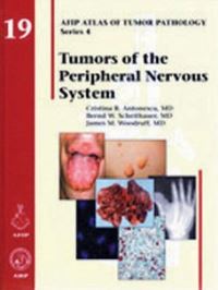 Book Cover for Tumors of the Peripheral Nervous System by Cristina R Antonescu, Bernd W Scheithauer, James M Woodruff